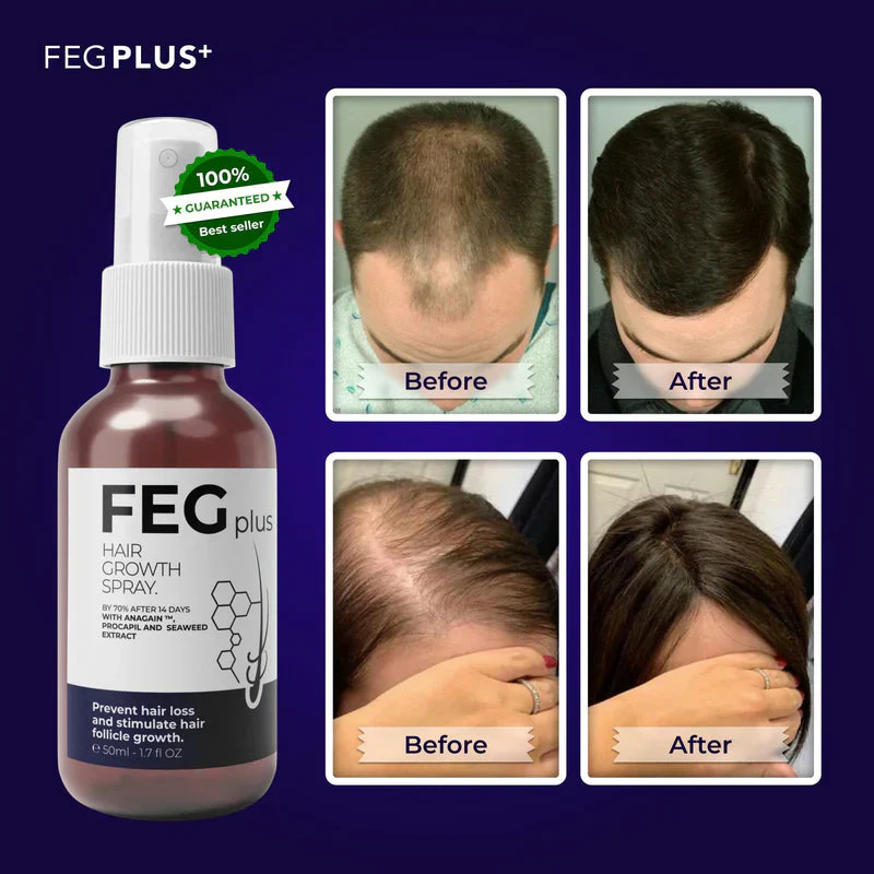 šEK K SAATH 1 MUFT LIMITED TIME OFFERš„Most Viral FEG Plus Hair Growth Spray - Image 4