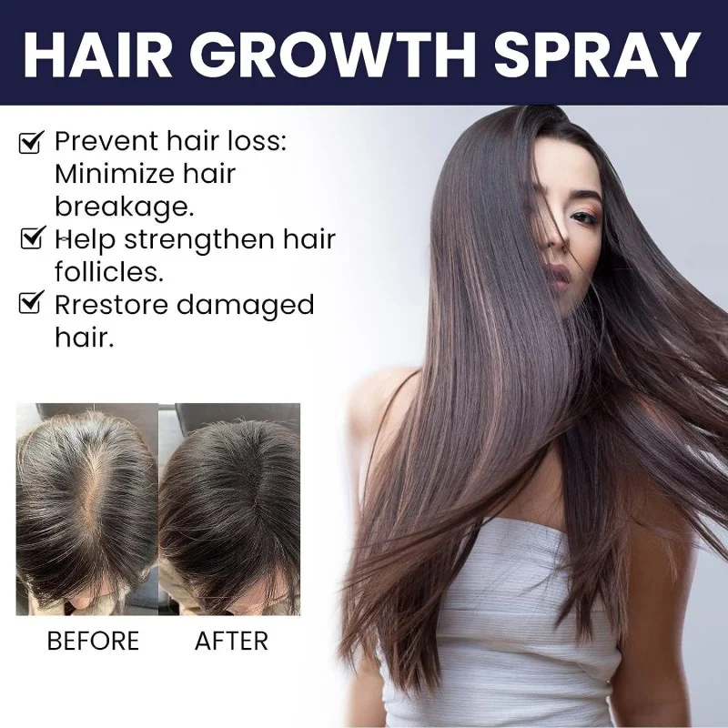 šEK K SAATH 1 MUFT LIMITED TIME OFFERš„Most Viral FEG Plus Hair Growth Spray - Image 5